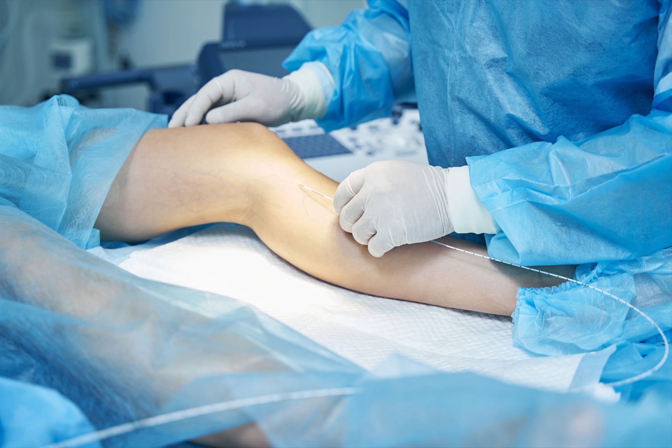 Phlebologist putting catheter into the vein. Effective treatment of varicose veins by Medapp.